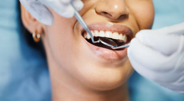 Best Emergency Cosmetic Dentistry (e.g., broken veneers) in Tawas City, MI