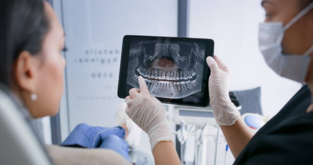 Best Knocked-Out Tooth (Avulsed Tooth) Treatment in Tawas City, MI